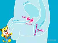 前列腺高潮真的存在吗？前列腺高潮技巧