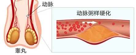血流自然不能顺利进入丁丁