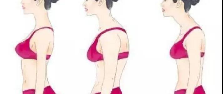 胸大的女生都会驼背