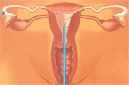 女人的阴道到底有多深
