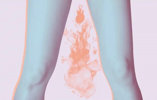 为什么女生会有体香