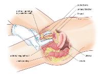 为了高潮，她去医院给G点打了一针