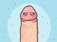 丁丁上有小疙瘩？这是性病吗...