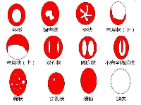 别再被欺骗了,不是每个女性都有处女膜！