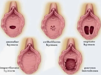 第一次没见红是处女膜没了吗？原来女生里面长这样！