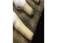 蘑菇头敏感度过高？自测+改善方案，速看！