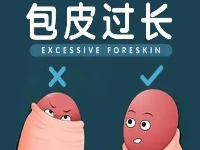 包皮术后的护理问题非常重要，千万不要不当回事！