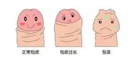 包茎