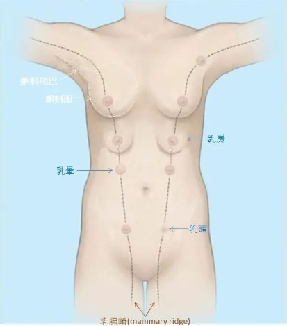 乳腺始基