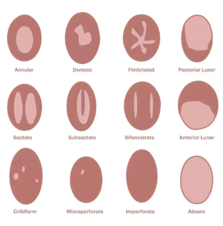 第一次性生活很痛吗