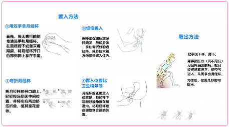 月经杯的使用方法