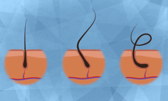 私处毛毛能刮吗？顺着刮还是逆着刮