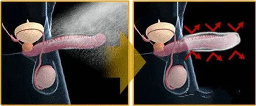 ▲起效原理示意图