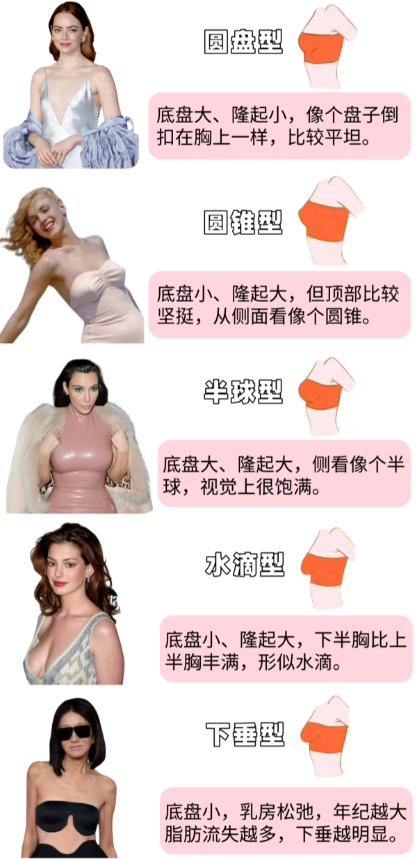 女生的胸部到底有几种形状