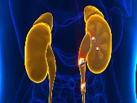 提高性能力的锻炼方法是什么 做什么训练可以提高性功能