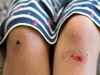 足疗保健有哪些好处？这两类人不适合做足疗