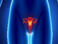 注意：宫颈糜烂可能导致不孕！