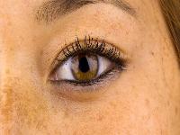 女性长期穿丁字裤或导致不孕