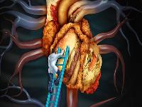 警惕:7大尴尬对男性生育能力有很大影响