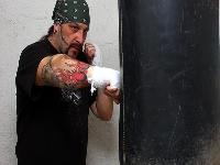 精囊炎的症状有哪些？男性摆脱精囊炎需要怎么做？