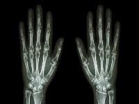 掰掰手指就能壮阳 记住指关节这五大穴位