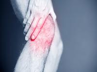 风湿性关节炎怎么治疗最好