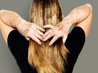 白癜风这种疾病怎么治疗好