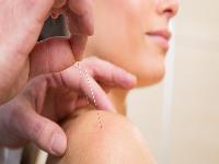 非布司他治疗痛风效果如何