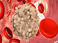 白细胞很高是不是白血病