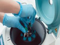 怎么确认是否贫血