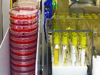 怎样知道是哪种贫血