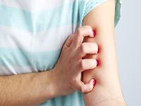 登革热被蚊子咬了有红点